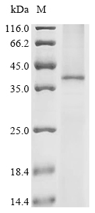 (Tris-Glycine gel) Discontinuous SDS-PAGE (reduced) with 5% enrichment gel and 15% separation gel. Boiling SDS-treated samples may result in membrane protein aggregation. Incubation at 37 centigrade for 10 min is an effective alternative.